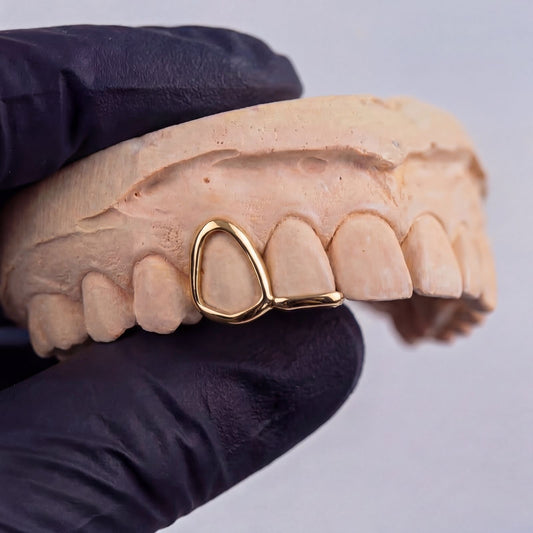 Custom Fitted Gold Or Silver Window Or Inlay Tip Grillz
