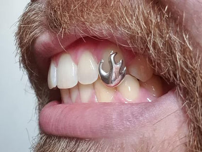 Flames Style Fire Cap Custom Made Grillz