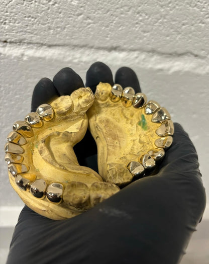 Full Mouth Gold Slugz (6 teeth) Custom Made Grillz